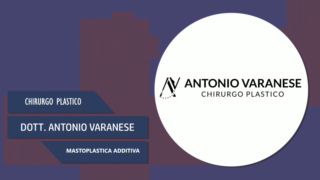 Intervista al Dott. Antonio Varanese – Mastoplastica Additiva